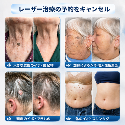 🎮薬剤師もおすすめ HISKIN® 7日間 タグ＆スポットイレーサー🪄 （痛みゼロ・傷あとゼロを目指すローラーボールタイプ）👩‍⚕️